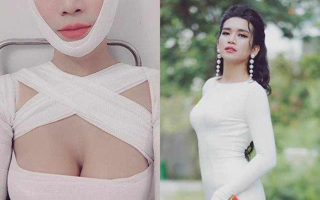Rộ tin BB Trần dao kéo vòng 1, loạt sao Việt mắt tròn mắt dẹt Ảnh 2