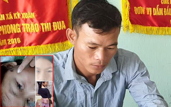 Công an viên đánh bé gái 12 tuổi nhập viện vì nghi trộm 50.000 đồng: Dùng gậy đánh nhẹ vài cái để răn đe Ảnh 2