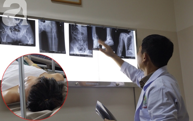 Gia đình ngăn cản không cho 'lấy chồng', thanh niên liền nhảy từ lầu 4 chung cư dẫn đến đa chấn thương Ảnh 2