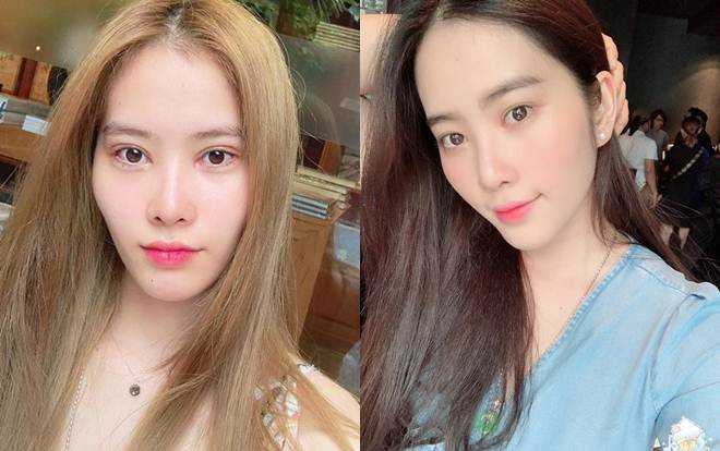 Lần đầu can thiệp dao kéo, Nam Em bị nhận xét không đẹp mà còn hốc hác hơn Ảnh 2