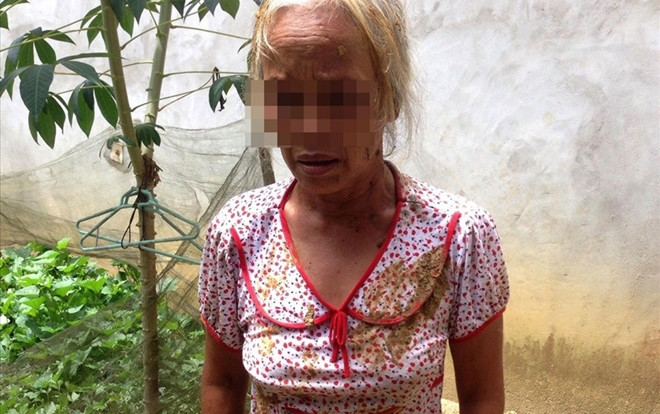 Mâu thuẫn đất đai với hàng xóm, bà già tố bị 2 thanh niên nhét phân bò vào miệng Ảnh 2