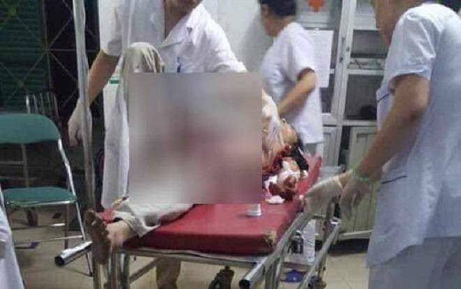 Con rể cầm dao đâm bố mẹ vợ nguy kịch do mâu thuẫn gia đình Ảnh 2