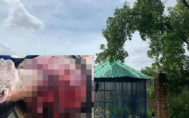 Vụ hổ cắn đứt lìa 2 tay người đàn ông trong khu du lịch: 'Giật mình tôi kéo ra thì con hổ ngoạm luôn cả 2 tay' Ảnh 2