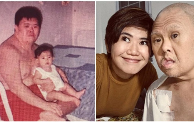 Bức thư con gái viết dành tặng người cha mắc bệnh Down lấy nước mắt hàng triệu người Ảnh 2