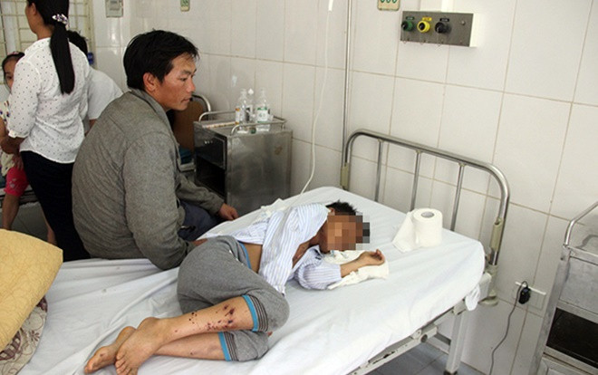 Sử dụng điện thoại lúc trời mưa, hai em nhỏ bị sét đánh nhập viện Ảnh 2