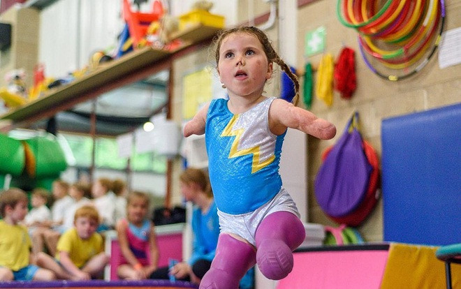 Nghi lực phi thường của bé gái cụt tứ chi mê làm vận động viên thể dục là nguồn cảm hứng cho hàng triệu người Ảnh 2