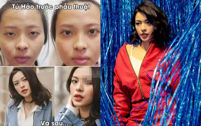 Sau 2 năm đăng quang, Tú Hảo vẫn bị lôi ảnh bị nghi là phẫu thuật thẩm mỹ ra bàn tán Ảnh 2