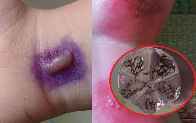 Sinh viên KTX ĐHQG TP.HCM lo lắng vì liên tục bị kiến ba khoang 'tấn công' Ảnh 2