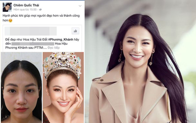 Fan sốc khi biết số lần Hoa hậu Phương Khánh phẫu thuật thẩm mỹ để có nhan sắc nữ thần như hiện tại Ảnh 2