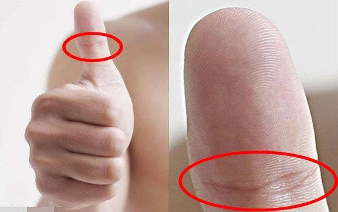 Liếc qua ngón tay cái biết ngay ai 'nhiều tiền lắm của', ai 'nghèo rớt mồng tơi' Ảnh 2