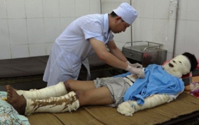 Nổ bình gas trong đám tang, 5 người bị bỏng nặng Ảnh 2