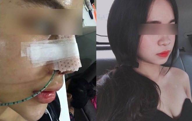 Cô gái Việt nâng mũi sửa cằm cho đẹp ai ngờ 'đổi vận', thăng hạng cả tình lẫn tiền Ảnh 2