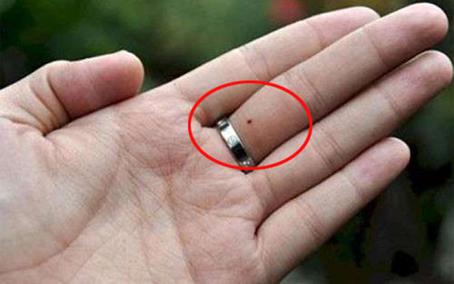 Sở hữu một trong những nốt ruồi phú quý này, không sớm thì muộn ắt cũng giàu ‘nứt đố đổ vách’ Ảnh 2