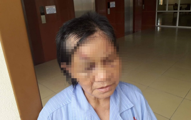 Công an điều tra cháu trai nghi trói chân tay, bịt mồm đánh bà ngoại gãy 5 xương sườn Ảnh 2