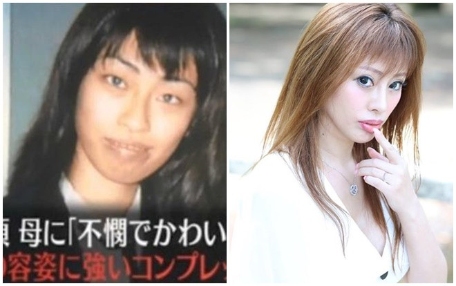 Cô gái chi 6,5 tỉ phẫu thuật thẩm mỹ 300 lần và nguyên nhân đáng kinh ngạc Ảnh 2