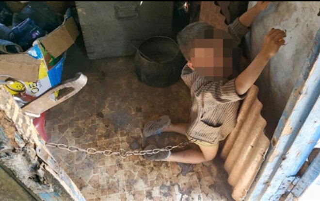 Đau lòng hình ảnh cậu bé 6 tuổi bị cha mẹ xích trước cửa nhà chỉ vì nghịch ngợm Ảnh 2