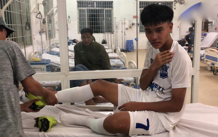 Đàn em Công Phượng dính chấn thương kinh hoàng, gãy xương Ảnh 2