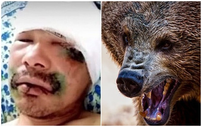Kinh hãi giây phút người đàn ông bị gấu hoang ngoạm đầu, cấu xé Ảnh 2