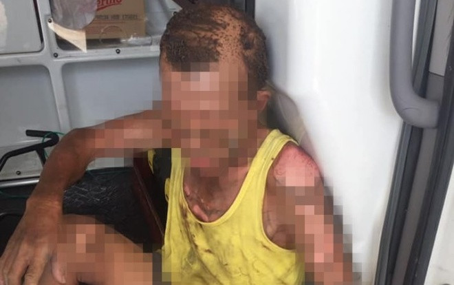 Đổ can xăng lên người bố đẻ thiêu sống rồi cùng tự sát, con tử vong cha nguy kịch Ảnh 2