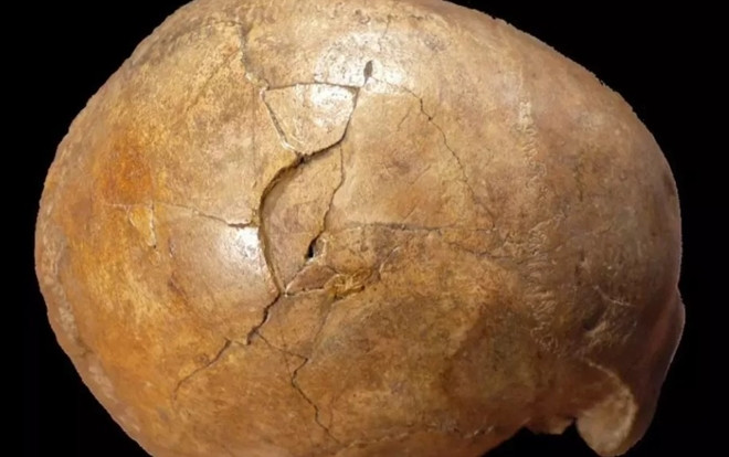 Phát hiện sốc về hộp sọ nứt của người đàn ông 33.000 năm trước Ảnh 2