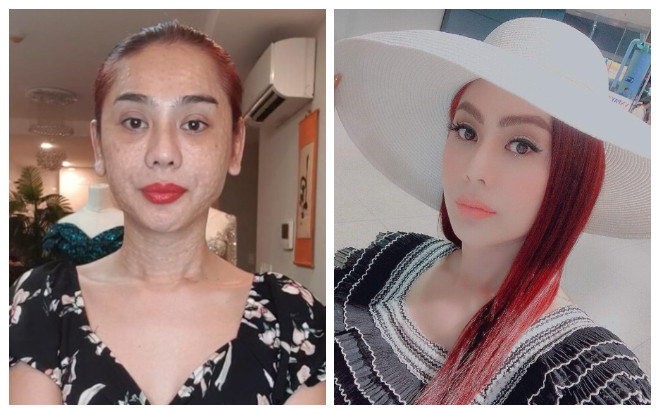 Lâm Khánh Chi xuất hiện với nhan sắc xinh đẹp rạng rỡ sau khi lộ gương mặt sần sùi kém sắc Ảnh 2