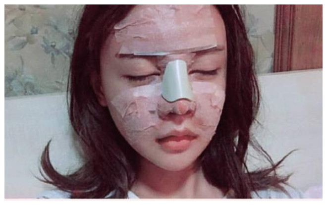 Hot girl Trung Quốc mới 20 tuổi đã dao kéo trên mặt hết 33 lần, nhan sắc hiện tại khiến ai nhìn cũng hoảng Ảnh 2