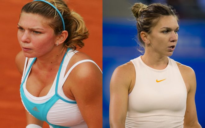 Quá khổ vì ngực khủng, 'hoa khôi quần vợt' phẫu thuật nhỏ và cái kết bất ngờ Ảnh 2