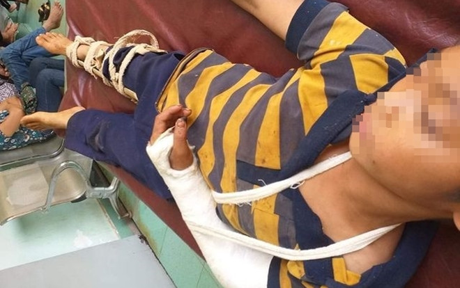 Bé trai 11 tuổi ở Đắk Nông nghi bị hàng xóm đánh trọng thương phải nhập viện Ảnh 2