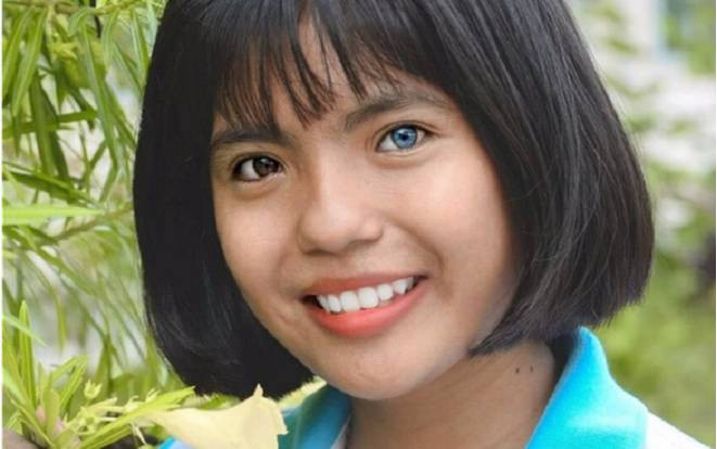 Nữ sinh với đôi mắt 2 màu ấn tượng được ĐH Nha Trang hỗ trợ việc làm thêm, miễn phí ở KTX 4 năm học Ảnh 2