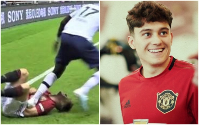 CĐV Man Utd 'phát điên' vì hot boy mới nổi bị cầu thủ Tottenham giẫm lên ngực Ảnh 2