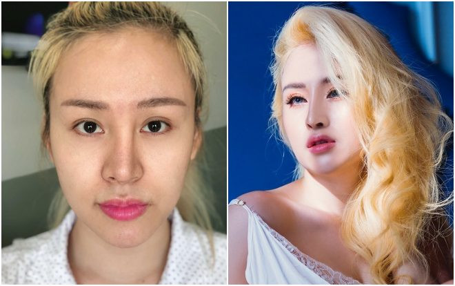 Trầm cảm vì mũi biến dạng đau đớn sau phẫu thuật, 'bà Tưng' Huyền Anh sửa mũi lần 4, kết quả thật đáng ngạc nhiên Ảnh 2