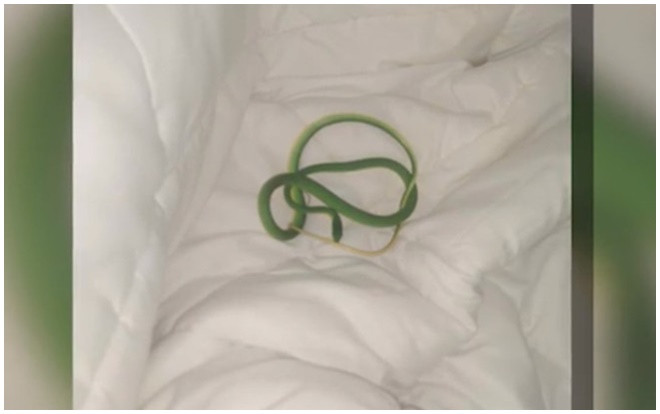 Tỉnh dậy tại khách sạn, người phụ nữ thất kinh khi thấy rắn bò quanh tay Ảnh 2