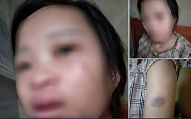 Người vợ mang bầu 8 tháng bị chồng đánh bầm dập vì dám đặt một đôi giày 135k trên mạng Ảnh 2