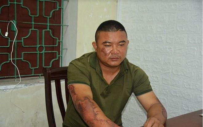 Đã bắt được đối tượng tạt xăng châm lửa đốt khiến 5 người trong nhà bị thương Ảnh 2