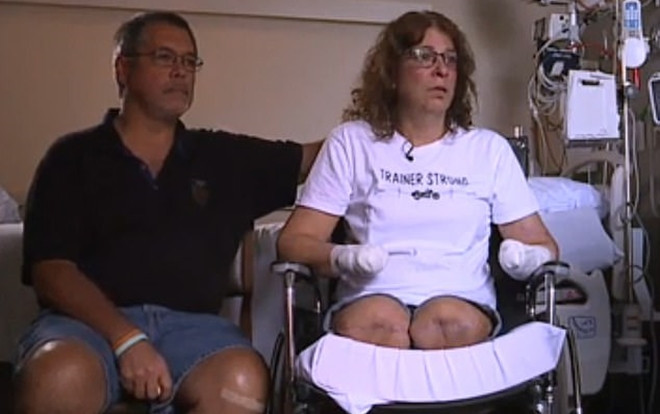 Để chó nhà liếm tay, thợ làm tóc phải cắt cụt tứ chi Ảnh 2