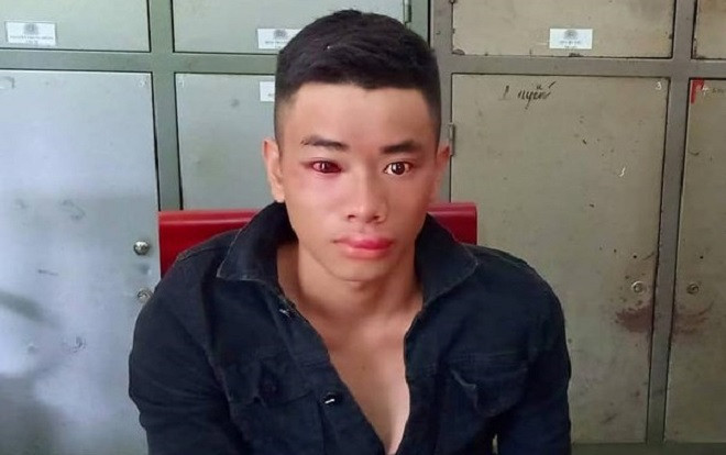 Con nghiện dùng kim tiêm đâm bị thương thiếu úy công an Ảnh 2