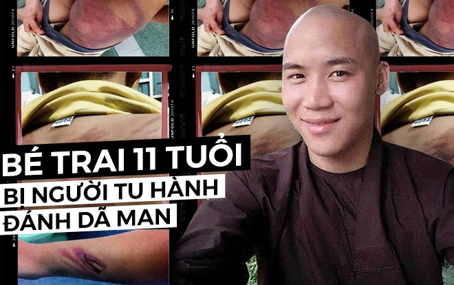 Vụ bé trai 11 tuổi bị người tu hành đánh dã man: Người trong cuộc nói gì? Ảnh 2