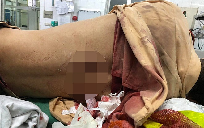 Vi phạm bị giữ xe, người đàn ông về nhà lấy dao quay lại đâm lén Trung úy CSGT Ảnh 2