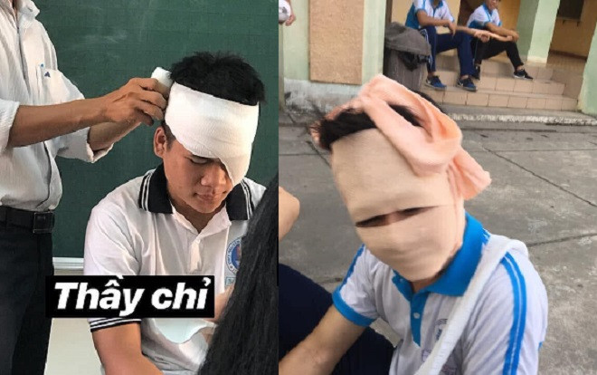 Loạt ảnh 'thầy chỉ' và 'học sinh làm' khi băng bó vết thương trong kỳ học quân sự khác nhau '1 trời 1 vực' khiến CĐM cười lăn Ảnh 2