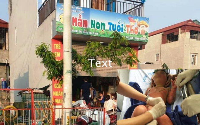 Tạm đình chỉ nhóm lớp trẻ tư thục sau vụ 3 trẻ mầm non bị bỏng nặng khi học kỹ năng kêu cứu và thoát hiểm Ảnh 2