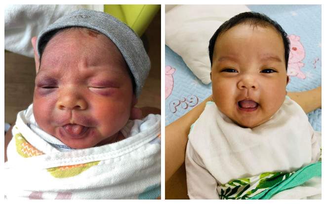 Hải Băng công khai ảnh con trai út hồi mới lọt lòng 'tím tái', ai nhìn cũng xót xa Ảnh 2