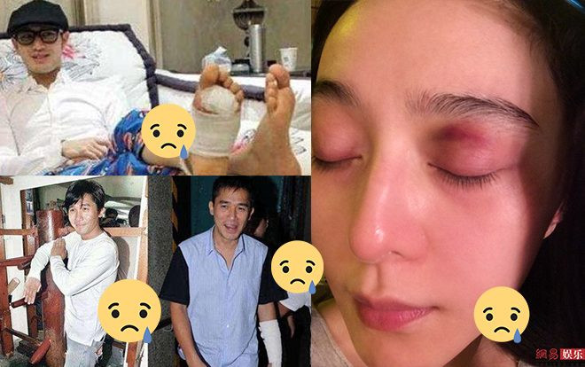 Tai nạn nguy hiểm trên phim trường của sao Hoa Ngữ: Phạm Băng Băng suýt mù mắt, Phùng Thiệu Phong bị ngựa hất văng Ảnh 2