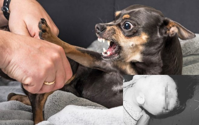 Bé trai 2 tuổi ở Hà Nội bị chó của người thân tấn công, cắn rách đầu và mặt nhập viện cấp cứu Ảnh 2