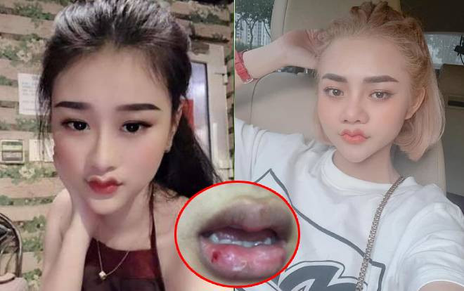 Chị em thi nhau bắt trend môi 'cánh én', anh em hoảng hốt xin đừng ám ảnh nhau! Ảnh 2