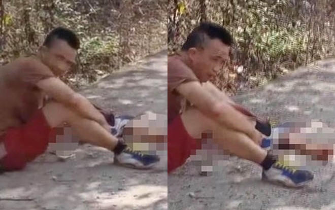 Bị tai nạn đứt lìa cả cẳng tay, người đàn ông vẫn bình tĩnh ngồi đợi người đến giúp Ảnh 2