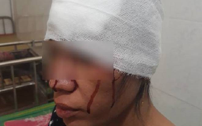 Người phụ nữ khuyết tật đang mang thai 8 tháng bị người cùng xã đến nhà hành hung phải nhập viện Ảnh 2