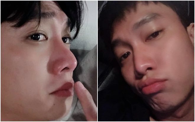 Quốc Trường 'giận dỗi' đăng ảnh cận mặt để chứng minh mình không sửa mũi Ảnh 2