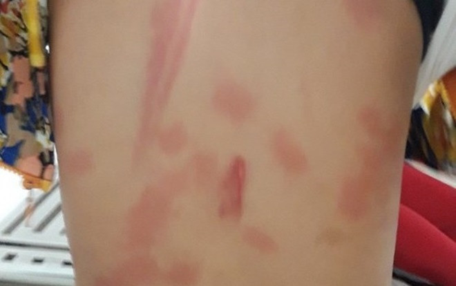 Bé trai ở Tiền Giang bị đánh thương tích 13%: Khởi tố một phụ nữ Ảnh 2