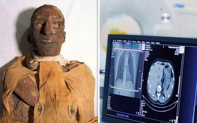 Ảnh chụp cắt lớp hé lộ chi tiết sốc trong vụ ám sát dã man Pharaoh Ai Cập Ảnh 2