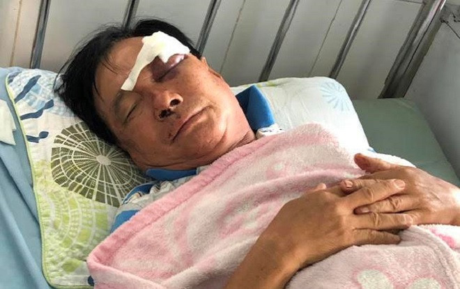 Mâu thuẫn việc tranh giành tài sản, con rể dùng chai bia đánh bố vợ nhập viện Ảnh 2